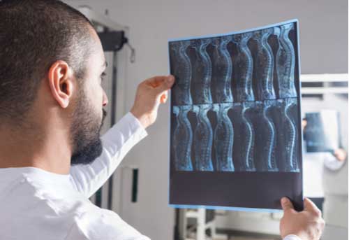Doctor looking at spinal x-ray Fort Myers spine injury treatment concept