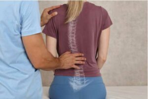 Picture with a chiropractician and a patient that has scoliosis