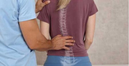 physiotherapy for scoliosis