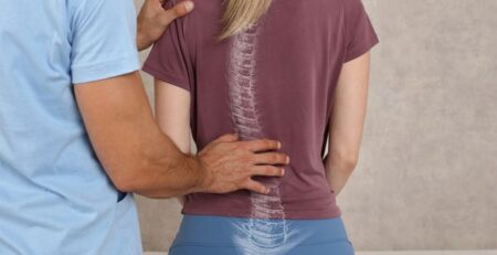 chiropractor treating woman for poor posture