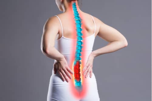 Concept of Pompano Beach sciatica treatment woman with back pain