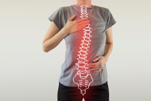 Curved spine, concept of Sunrise scoliosis treatment