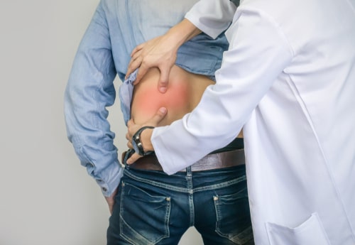 Davie sciatica treatment doctor examining man with back pain