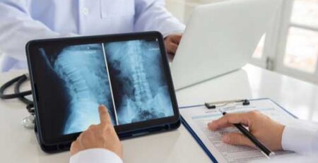 spinal cord