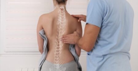 Scoliosis Spine Curve Anatomy Posture Correction