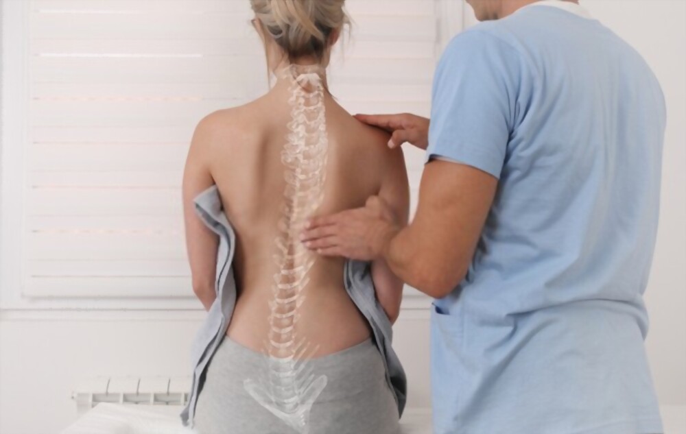 Scoliosis Spine Curve Anatomy Posture Correction